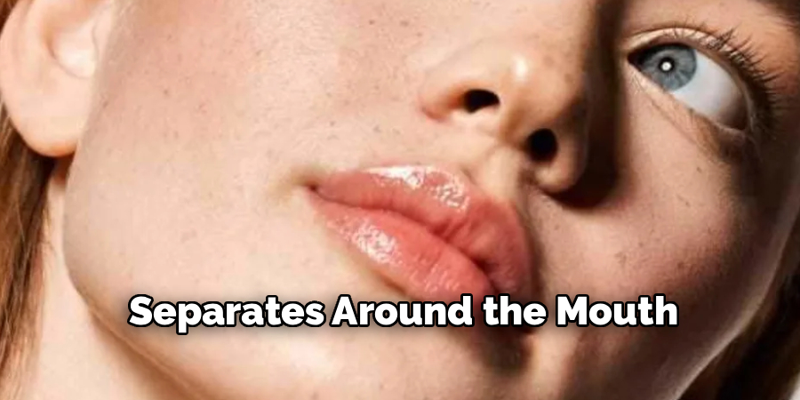 Separates Around the Mouth