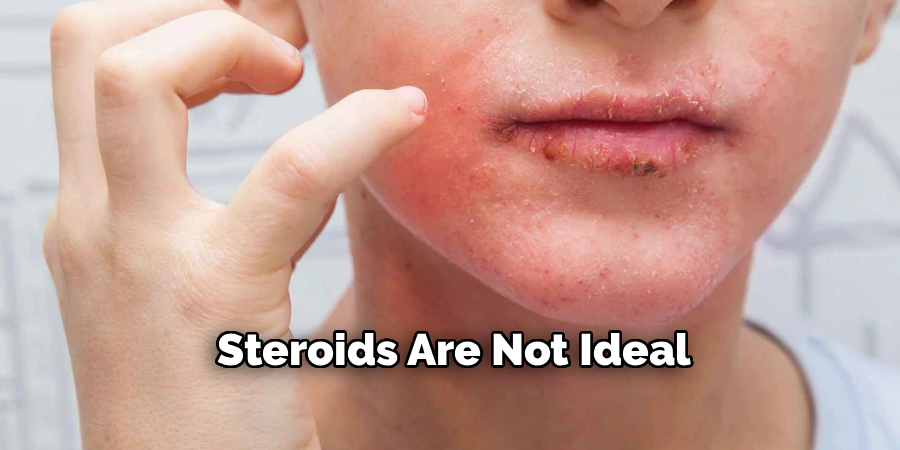 Steroids Are Not Ideal