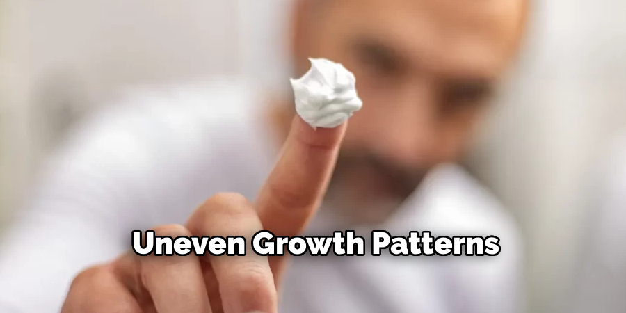 Uneven Growth Patterns