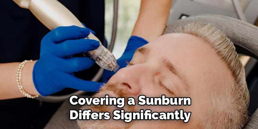 Covering a Sunburn Differs Significantly