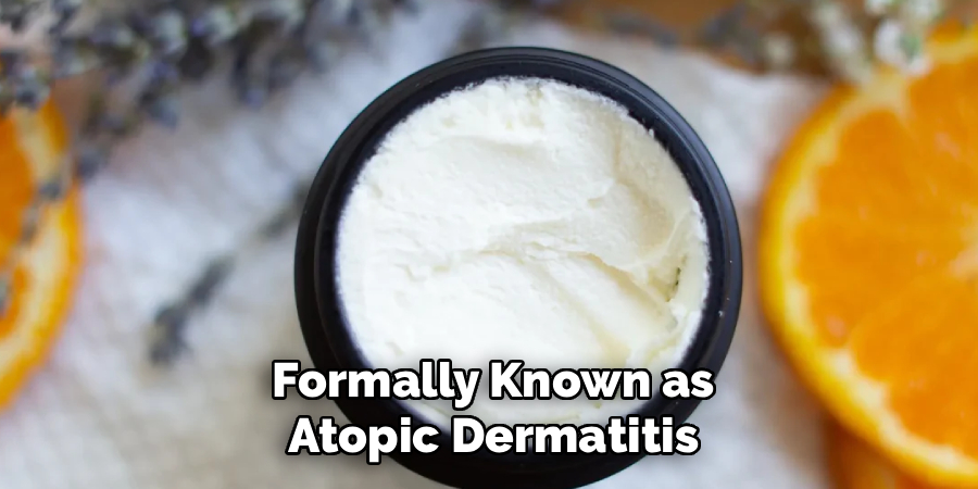 Formally Known as Atopic Dermatitis