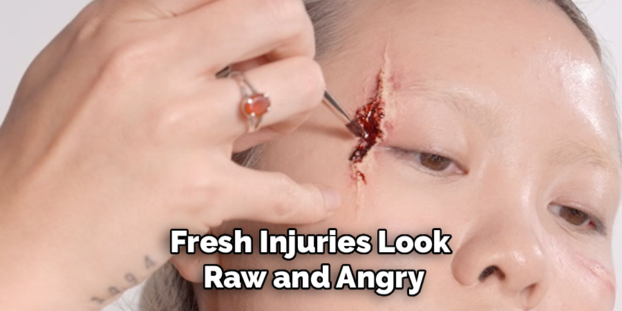 Fresh Injuries Look
Raw and Angry