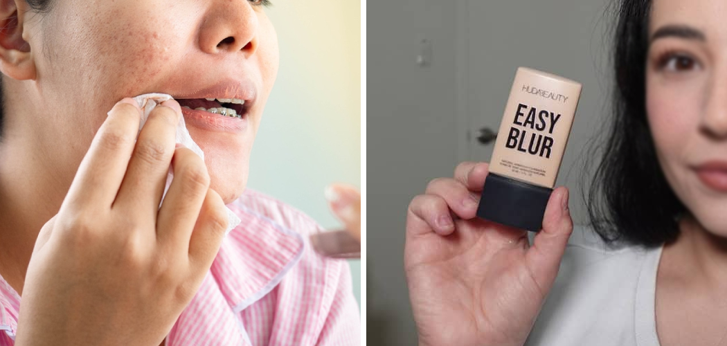How to Choose Powder Foundation for Acne Scars