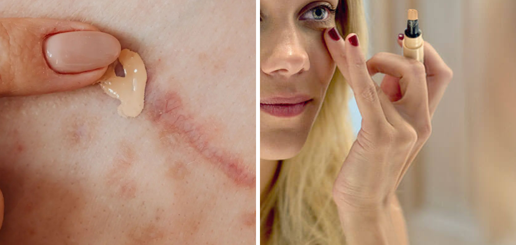 How to Cover Up Scars with Makeup