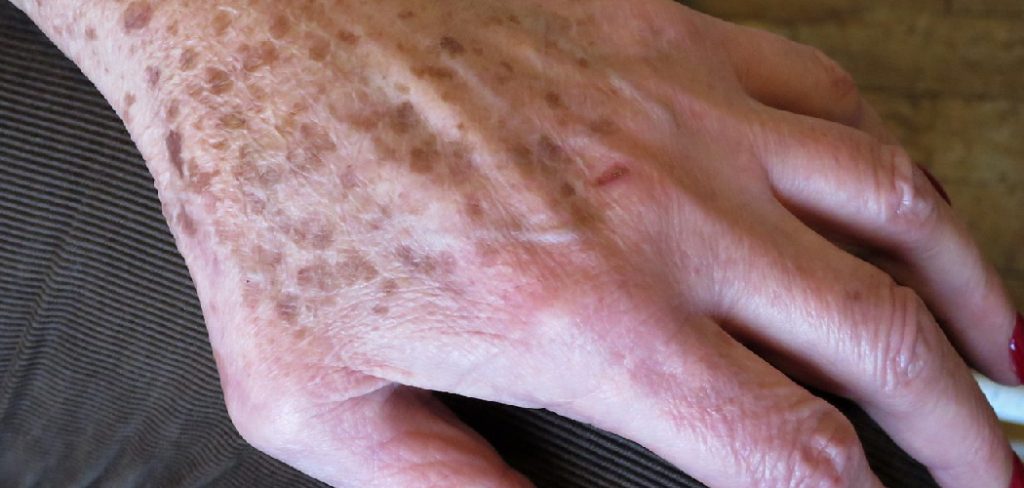 How to Remove Self Tanner From Hands Fast
