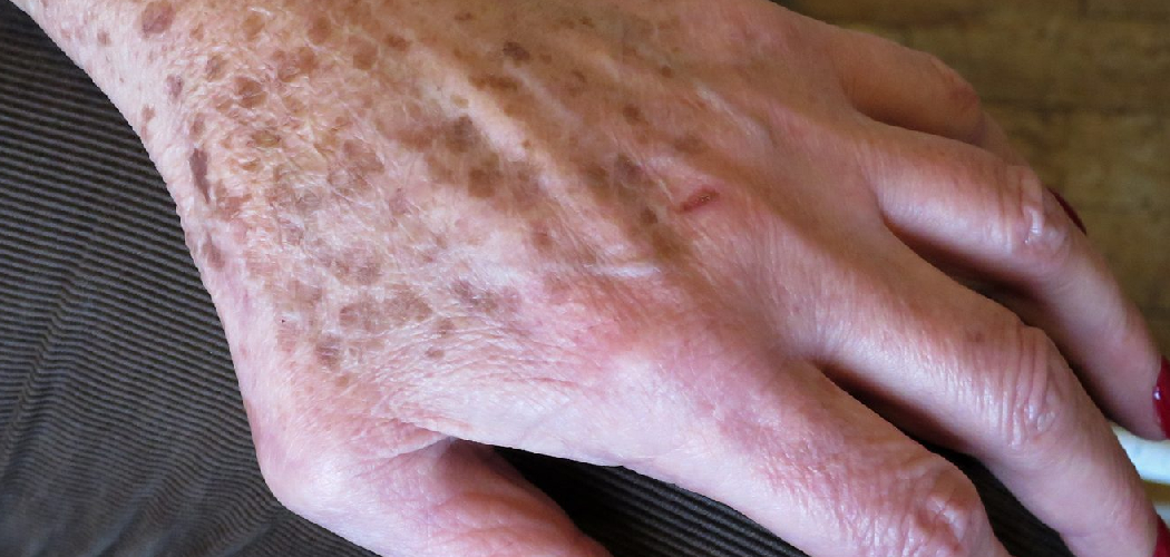 How to Remove Self Tanner From Hands Fast