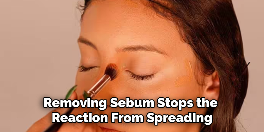 Removing Sebum Stops the
Reaction From Spreading