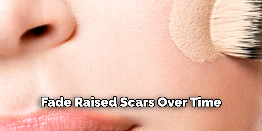 Fade Raised Scars Over Time
