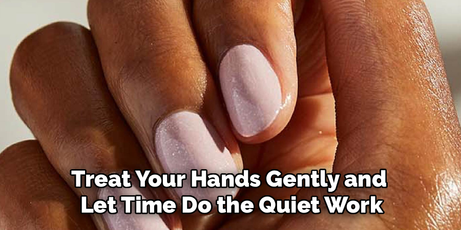 Treat Your Hands Gently and
Let Time Do the Quiet Work